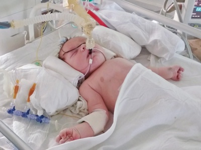 Ein kleiner Patient in der Geburtsklinik „Ramón Gonzáles Coro“